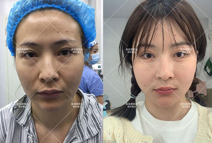 克拉玛依_2025年新澳门全年免费,谴责发现的全面释义、解释与落实